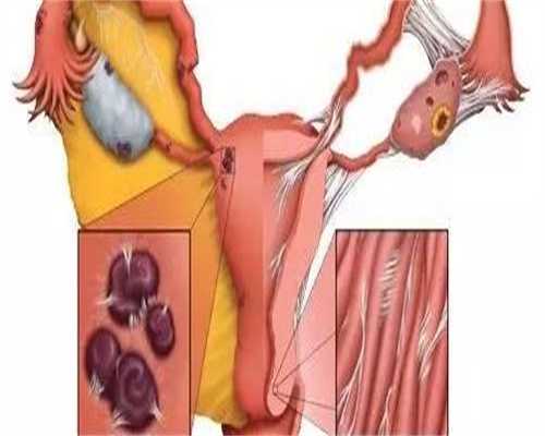试管婴儿进周费用全解析：从检查到手术的预算指南