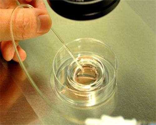 上海无创DNA产前检测，详解无创基因产检技术