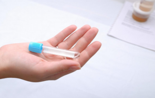 免疫问题试管检测项目解析与最佳检查时机