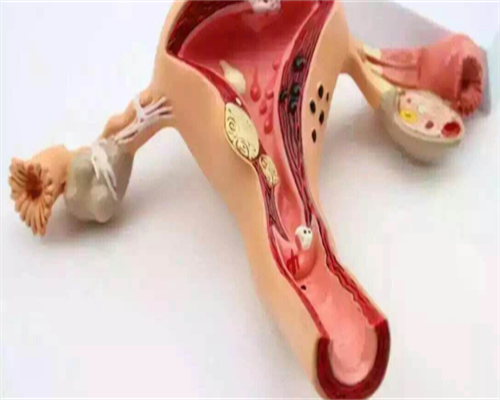 试管移植后宫颈筛查的重要性及操作指南