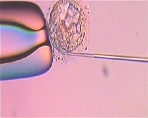 重庆代怀代生移植费用解析：包生代生与供卵龙凤胎套餐价格指南